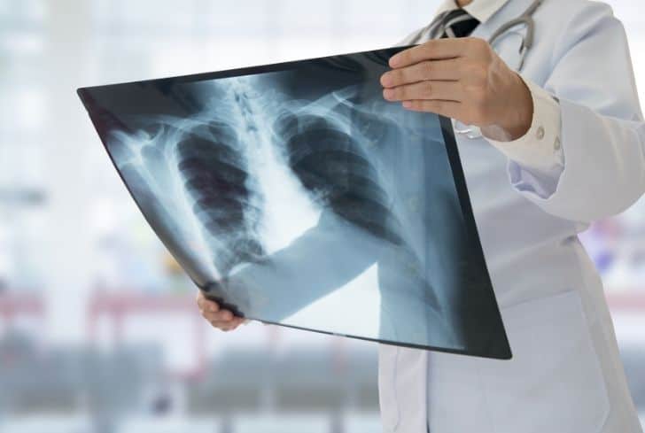 醫療廢物X射線報告銷毀